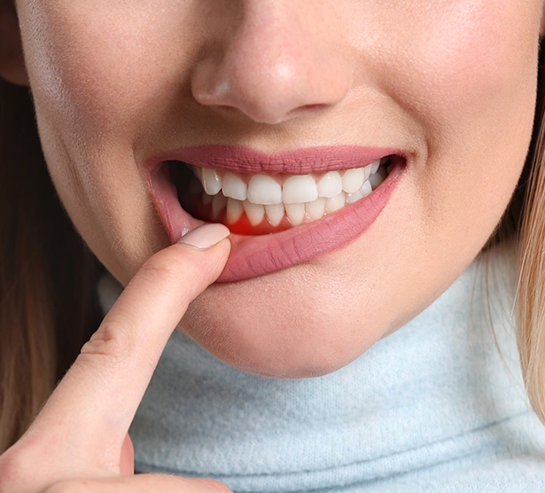 24 Hour Emergency Dental Care at Dentist Wandsworth