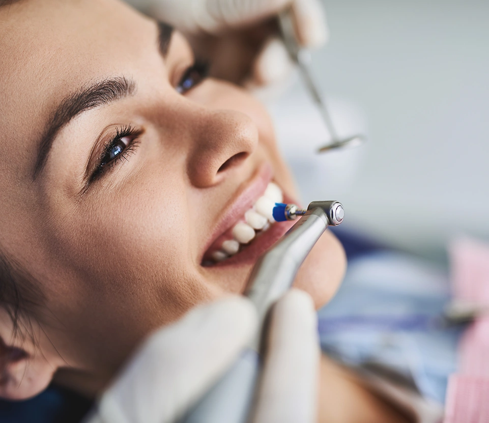Benefits of Seeing A Dental Hygienist - Dentist Wandsworth