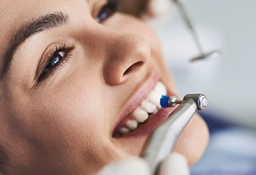 Composite Bonding treatment provider – Dentist Wandsworth