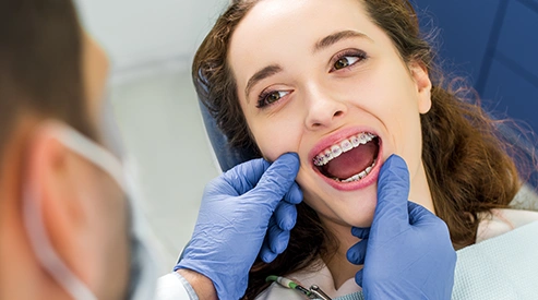 Crooked teeth treatment at Dentist Wandsworth