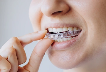 Invisalign& Clear Aligners
