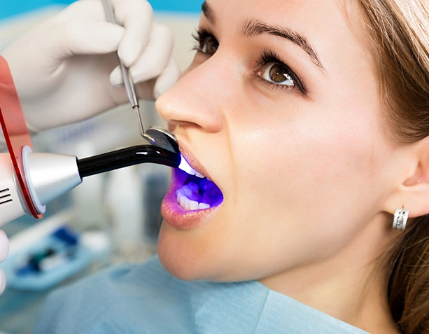 Loose Dental Filling treatment at Dentist Wandsworth