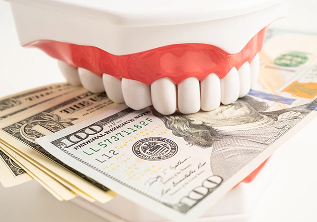 Treatments covered by finance – Dentist Wandsworth
