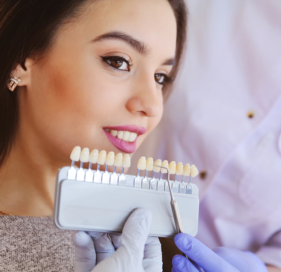 Composite Veneers Explained By Dentist Wandsworth
