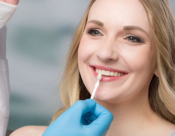 Veneers cost guide by Dentist Wandsworth